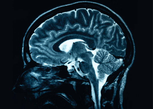 neurofiziologia